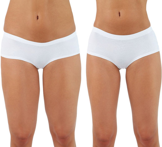 Liposuction Dayton OH